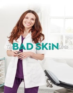 The Bad Skin Clinic Season  2 online