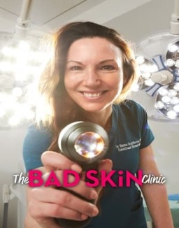 The Bad Skin Clinic Season  4 online